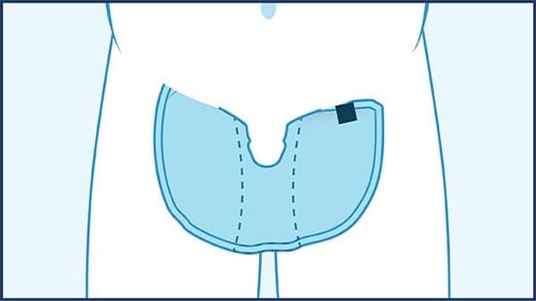 Wheelchair Users Application Instructions